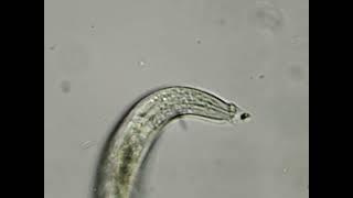 nematode eating a bacteria [upl. by Guinna]