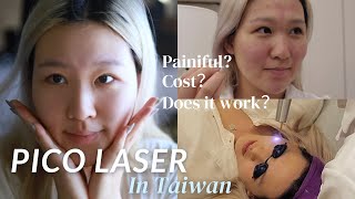 TAIWAN VLOG  IS PICO LASER WORTH IT  Skin treatment in Taiwan  Costs Where to go 皮秒雷射體驗 [upl. by Nelyahs]