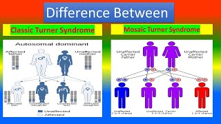 Classic Turner Syndrome and Mosaic Turner Syndrome [upl. by Schlesinger]