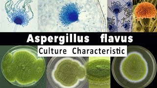 Aspergillus Flavus Culture Characteristic [upl. by Beckett]