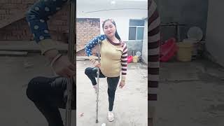 Polio with twisted crippled leg [upl. by Yalc]