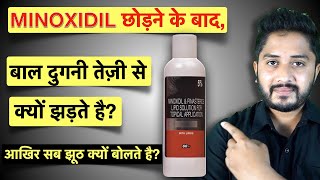 Minoxidil ke Side Effects Is it Safe to Use Minoxidil [upl. by Wrdna]