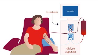 Hemodialyse bloeddialyse [upl. by Sihonn]