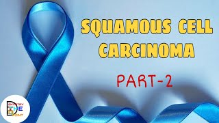 SQUAMOUS CELL CARCINOMA PART2 BENIGN AND MALIGNANT TUMORS OF ORAL CAVITY [upl. by Yelwar723]