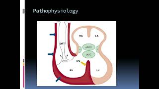 Cardiac Embryology The Key to Understanding Heart Development [upl. by Fredrick407]