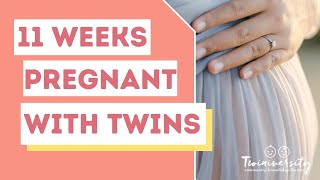 11 Weeks Pregnant with Twins  What to Expect [upl. by Thaxter]