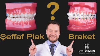 Invisalign Şeffaf Plak Ortodontik Tedavisi ile Braket  Diş teli  Karşılaştırması [upl. by Reviere]