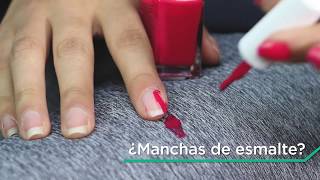 ¿Cómo eliminar manchas de esmalte [upl. by Pontus495]