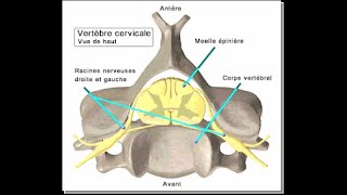 COMPRESSION MEDULLAIRE LENTE [upl. by Aneda526]
