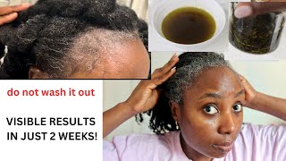 Your Hair Will Be Too Thick To Handle Just After 2 Weeks Of Using This Oil Grow Your Bald Spots [upl. by Cochrane]