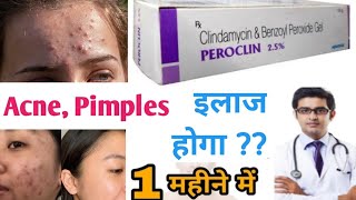 Peroclin Gel 25  Clindamycin amp Benzoyl Peroxide Gel  Peroclin 25 Gel how to use  peroclin [upl. by Strep]