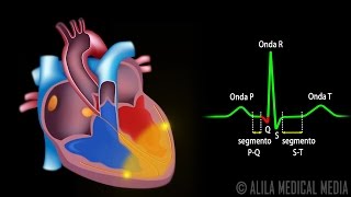 El Sistema de Conducción Cardíaca y la Relación con ECG Animación Alila Medical Media Español [upl. by Hong]