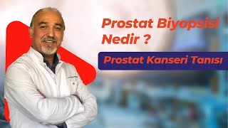 Prostat Biyopsisi Nasıl Alınır  Prostat Kanseri Tanısında Önemi Nedir [upl. by Ynamreg]