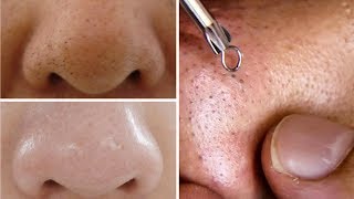 How To Do Facial Clean Up At Home Step By Step For Spotless Clear Skin Rabia Skincare [upl. by Undine309]