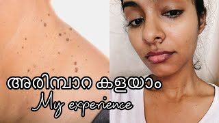 ACNE OR PIMPLES ON SCALP  Scalp Folliculitis  Causes amp Treatment DrRasya Dixit  Doctors Circle [upl. by Leizar329]