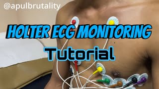 Holter ECG monitoring tutorial  placement recording and interpretation [upl. by Sil687]