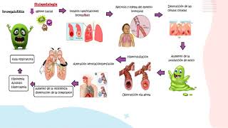 Bronquiolitis parte 1FisiopatologíaPediatría [upl. by Notlef]