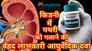 Himalaya cystone tabletusesdosage side effects in hindi for kidney stone [upl. by Jenkel]