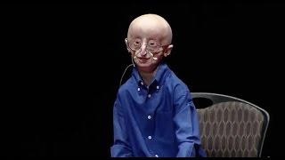 My philosophy for a happy life  Sam Berns  TEDxMidAtlantic [upl. by Liatrice]