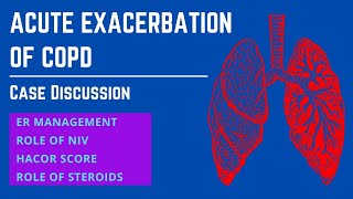 Case Presentation  Acute Exacerbation of COPD [upl. by Edahsalof]