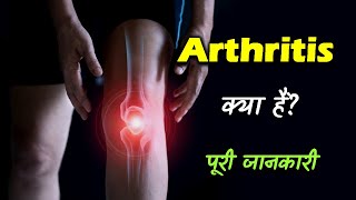 What is Arthritis With Full Information – Hindi – Quick Support [upl. by Nurat]