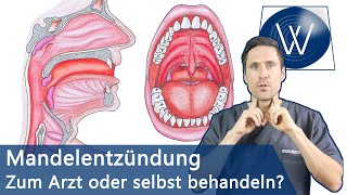 Mandelentzündung amp Halsschmerzen Schnell loswerden amp Was Sie wissen müssen wenn Sie betroffen sind [upl. by Pinter]