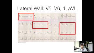 5 minute refresher 12lead EKG [upl. by Codd]