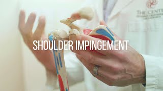 Shoulder Impingement Causes and Treatment [upl. by Adliwa187]