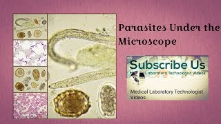 Parasites Under The Microscope [upl. by Leonor924]