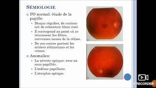 Oculomotricité et voies visuelles première partie [upl. by Dunstan]