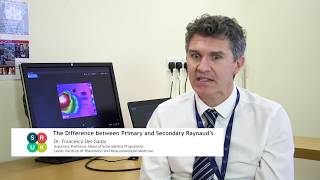 What are the differences between Primary and Secondary Raynauds [upl. by Dranoel]