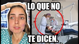 ME QUITARON LAS MUELAS DEL JUICIO ¿DUELE MUCHO [upl. by Hayley467]