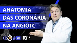 ANATOMIA DAS CORONÁRIAS NA ANGIOTC [upl. by Sheffy]