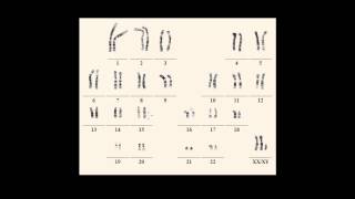 Karyotype notations [upl. by Noyart]