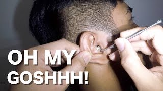 Mans Hard amp Dry Earwax Removal without applying Ear wax Softener [upl. by Hannahs]