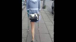 amputee on crutches 2 [upl. by Holcomb]