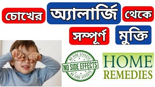 Eye allergy home remedies  চোখের অ্যালার্জি দূর করার ঘরোয়া উপায়  চোখYourstudyEducation [upl. by Anillek]