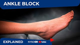 Regional Anesthesia UltrasoundGuided Ankle Block [upl. by Lopes408]