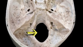 MNEMONIC  Foramen Magnum [upl. by Aerbas]