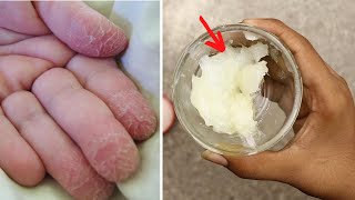 How To Get The Best Results From A Foot Peeling Mask [upl. by Lenaj]