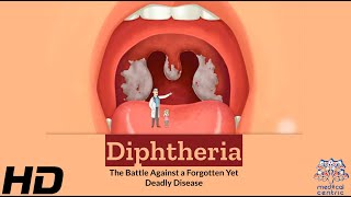 Diphtheria The Silent Battle Against a Deadly Disease [upl. by Evander245]