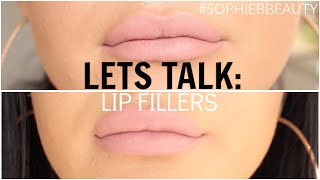 My Lip Fillers  Before During amp After  SophieBBeauty [upl. by Adlemy62]