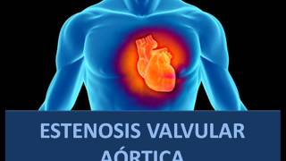 Estenosis valvular aórtica  Fisiopatología [upl. by Rees]