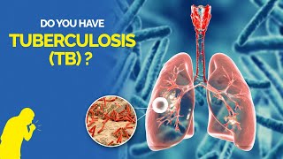 What is Tuberculosis TB Symptoms Causes Diagnosis and Treatment [upl. by Ide258]