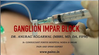 GANGLION IMPAR BLOCK [upl. by Polik309]