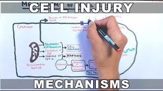 Mechanisms of Cell Injury [upl. by Dranik]