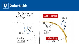 What is Cystic Fibrosis  Duke Health [upl. by Asa492]