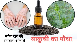 Bakuchi ka paudha  बाकुची की पहचान और फायदे  Bakuchi oil benefits  safed daag ka ayurvedic ilaj [upl. by Gnemgnok109]