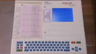 Medical Assistant Training Perform and Interpret an ECG [upl. by Reggy]