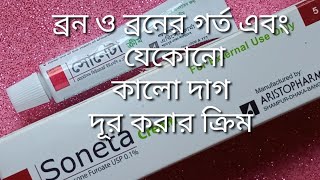 Mukher kalo dag dur korar creamত্বকে Soneta cream এর কাজ কি [upl. by Octavian]